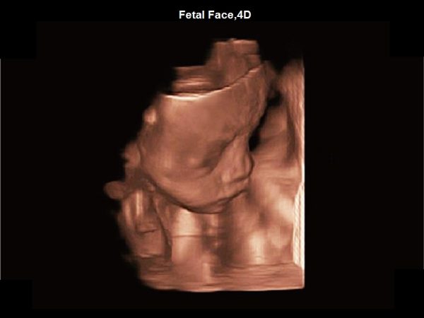 Fetal Face,4D