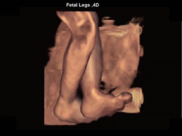 Fetal Legs ,4D
